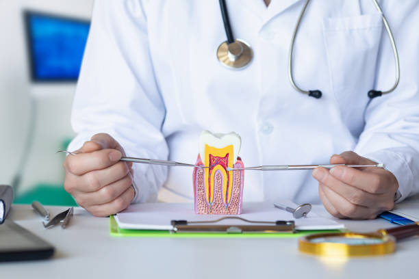 Best Knocked-Out Tooth (Avulsed Tooth) Treatment in Stone Mountain, GA